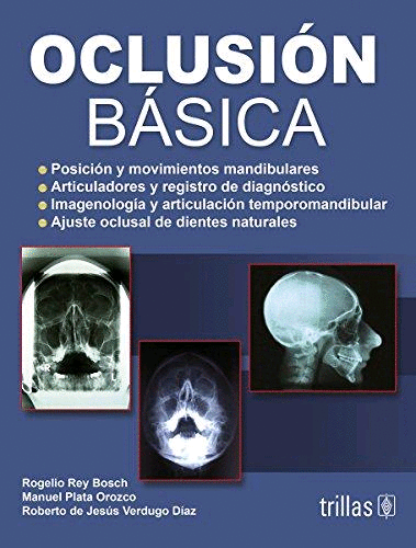 OCLUSION BASICA