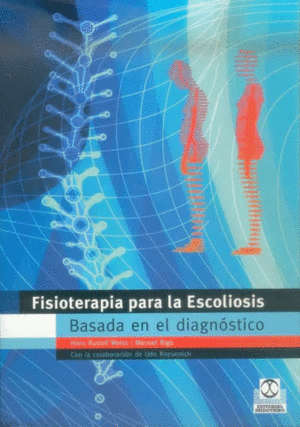 FISIOTERAPIA PARA LA ESCOLIOSIS