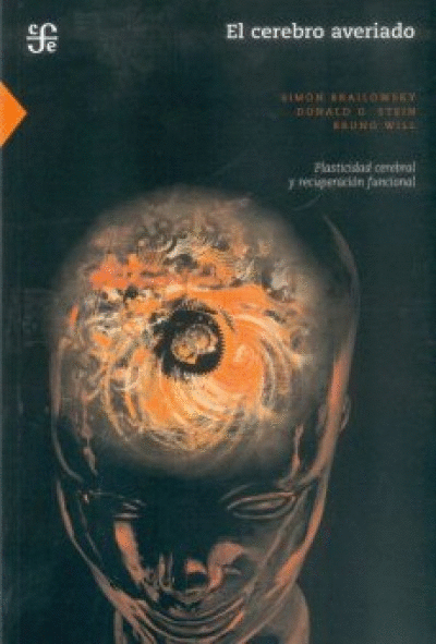 CEREBRO AVERIADO, EL