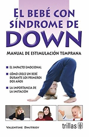 BEBE CON SINDROME DE DOWN, EL