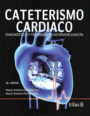 CATETERISMO CARDIACO