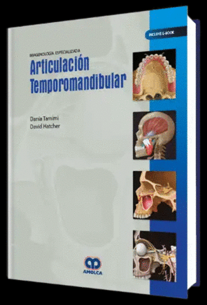 IMAGENOLOGÍA ESPECIALIZADA. ARTICULACIÓN TEMPOROMANDIBULAR