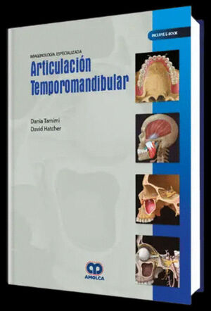 IMAGENOLOGÍA ESPECIALIZADA. ARTICULACIÓN TEMPOROMANDIBULAR